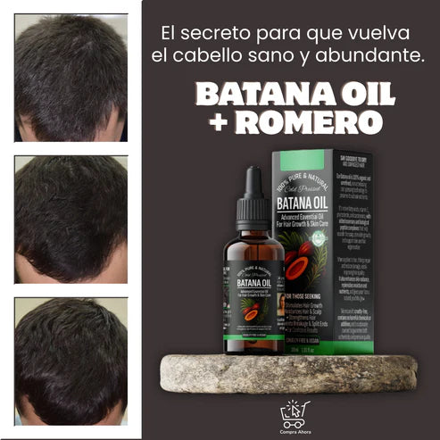 Aceite de Batana + Romero ORIGINAL OFERTA ESPECIAL 🤩